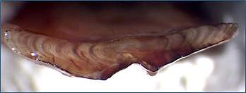Otolith of 9-year-old Copper Rockfish prepared for ageing. 